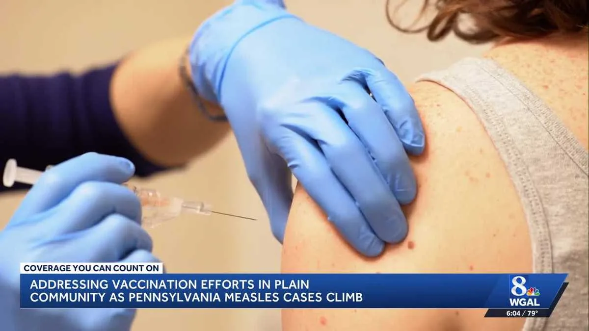 **Pennsylvania measles outbreak surpasses 900 cases; CDC reports 2 deaths, excludes state fatalities**